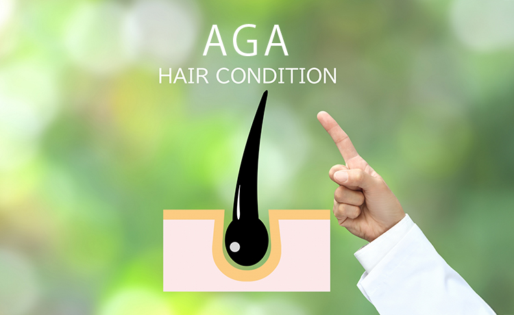 AGA治療